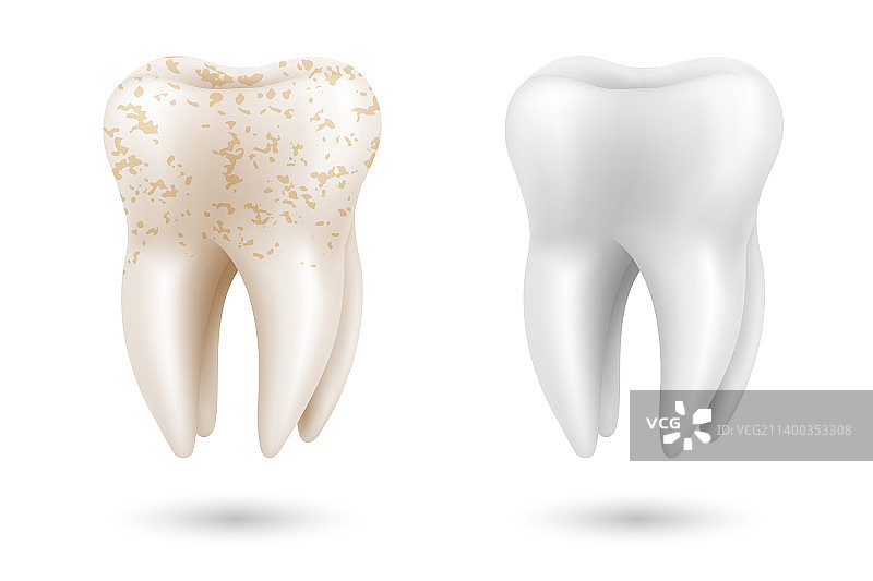 3D牙齿美白概念清洁对比图片素材