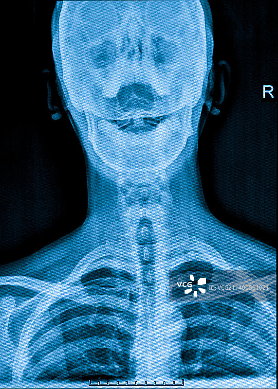 颈椎X光片图片素材