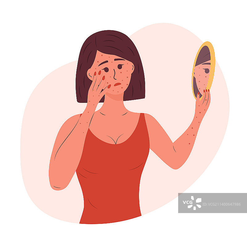 脸上和手上长满皮疹的悲伤女人图片素材