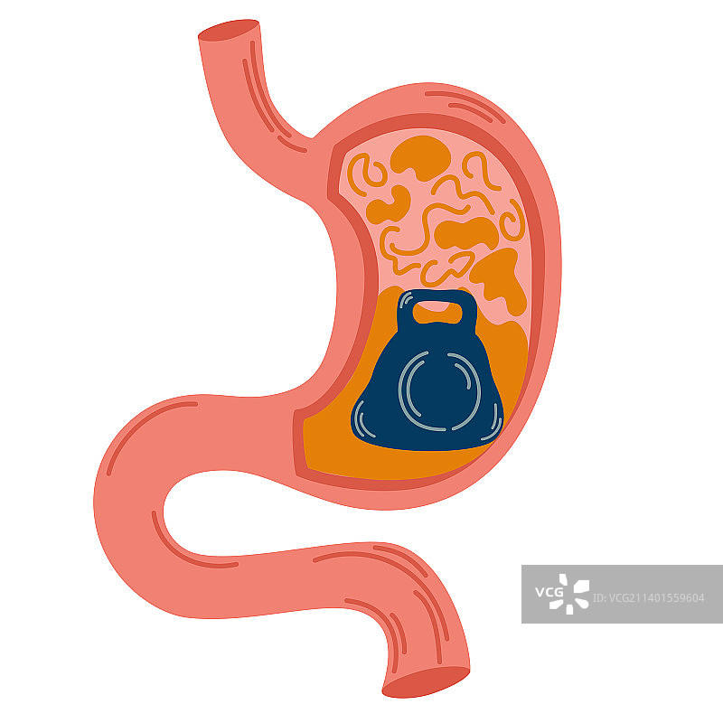 胃部沉重感，胀气，胃炎图片素材