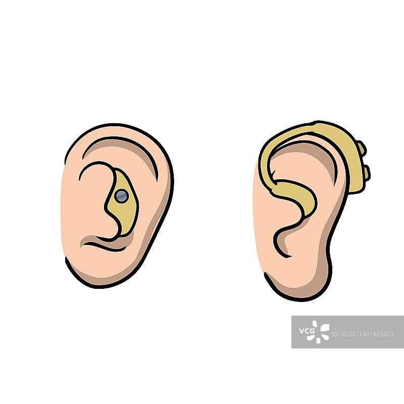 耳内助听器图片素材