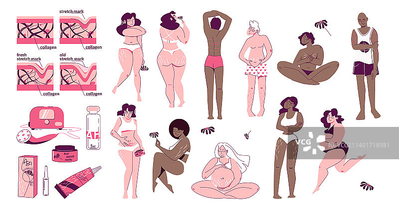 妊娠纹扁平风格合集图片素材