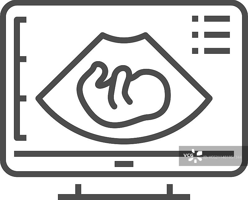 婴儿超声诊断图片素材