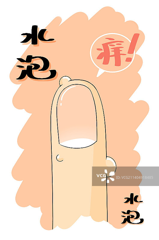 手指水泡——皮肤问题系列卡通海报图片素材