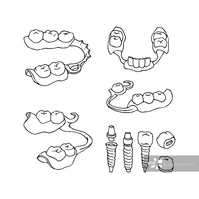 带牙冠的钛种植体图片素材