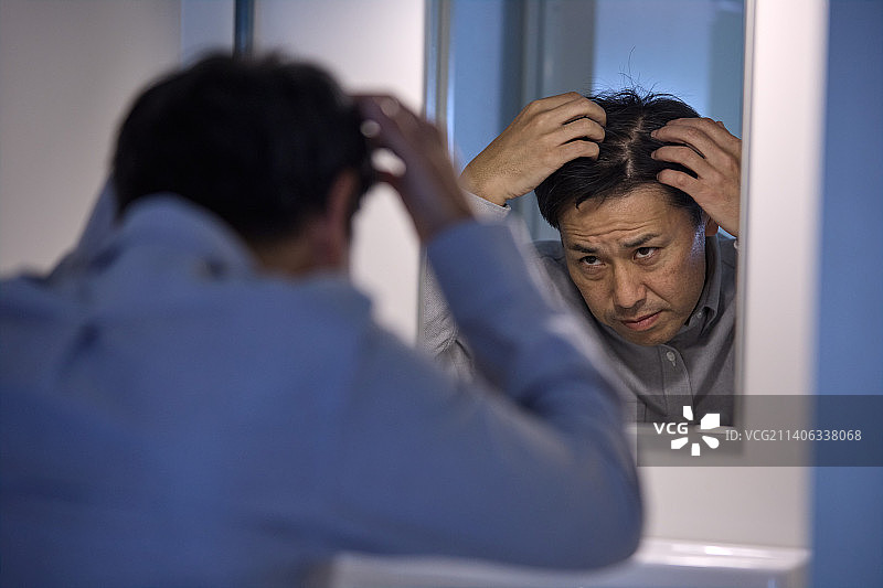 为脱发苦恼的日本男人图片素材