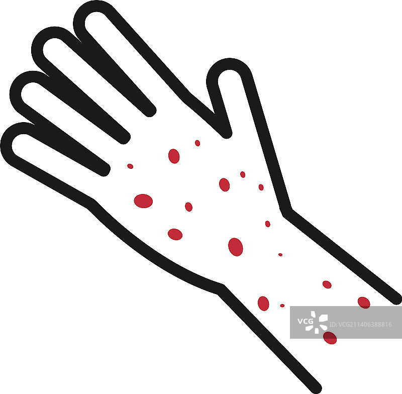 人手上红色皮疹疾病症状图标图片素材