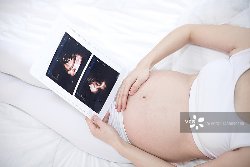 孕妇在查看B超报告图片素材