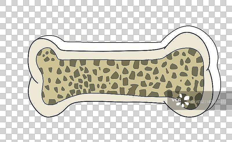 元素：骨质疏松的骨头图片素材