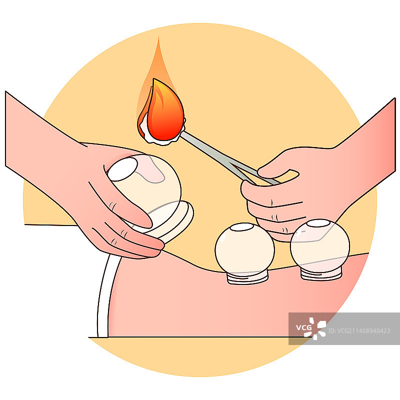 中医拔火罐矢量描边插画图片素材