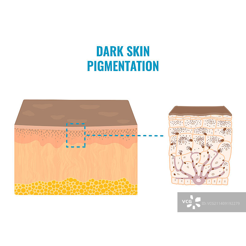 深色皮肤中的肤色色素沉着机制图片素材