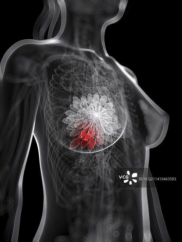 乳腺癌艺术作品图片素材