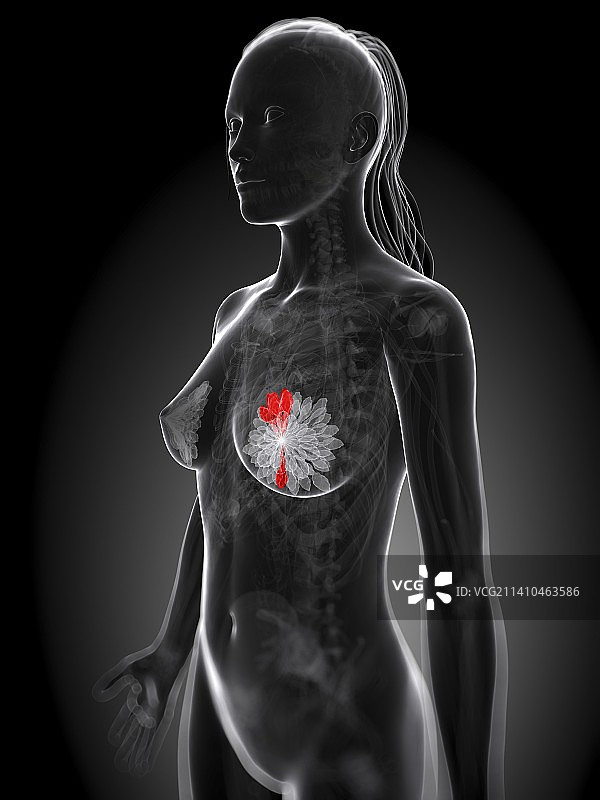 乳腺癌艺术作品图片素材