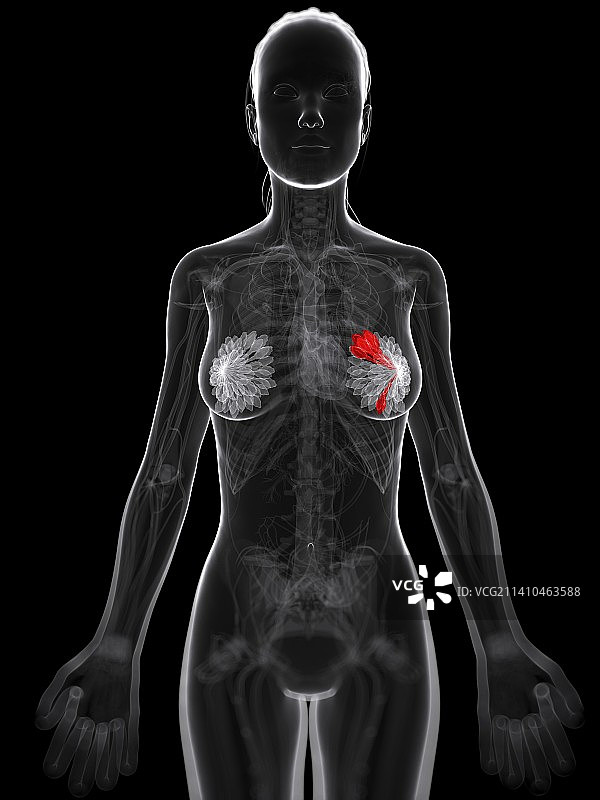 乳腺癌艺术作品图片素材