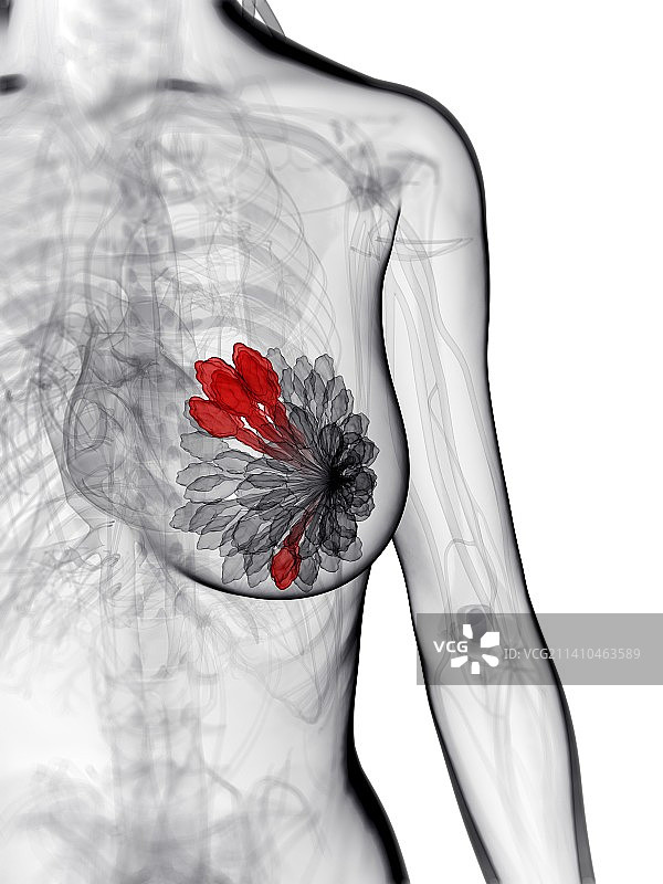 乳腺癌艺术作品图片素材