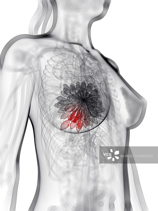 乳腺癌艺术作品图片素材