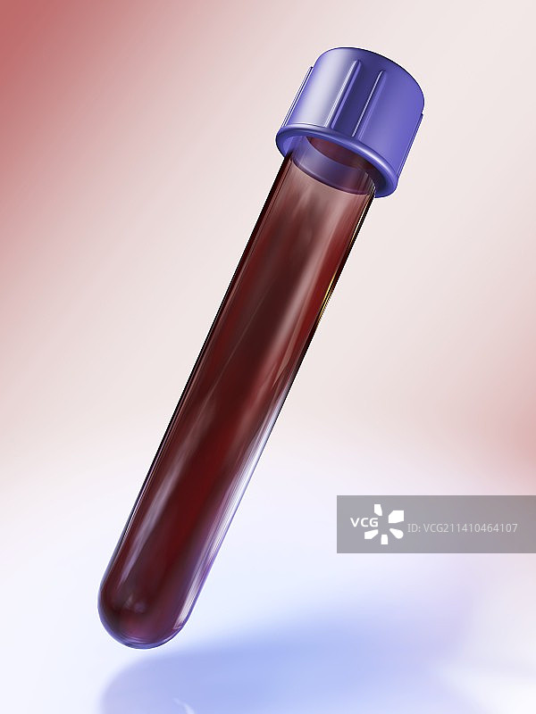 带血液的医疗试管，艺术作品图片素材