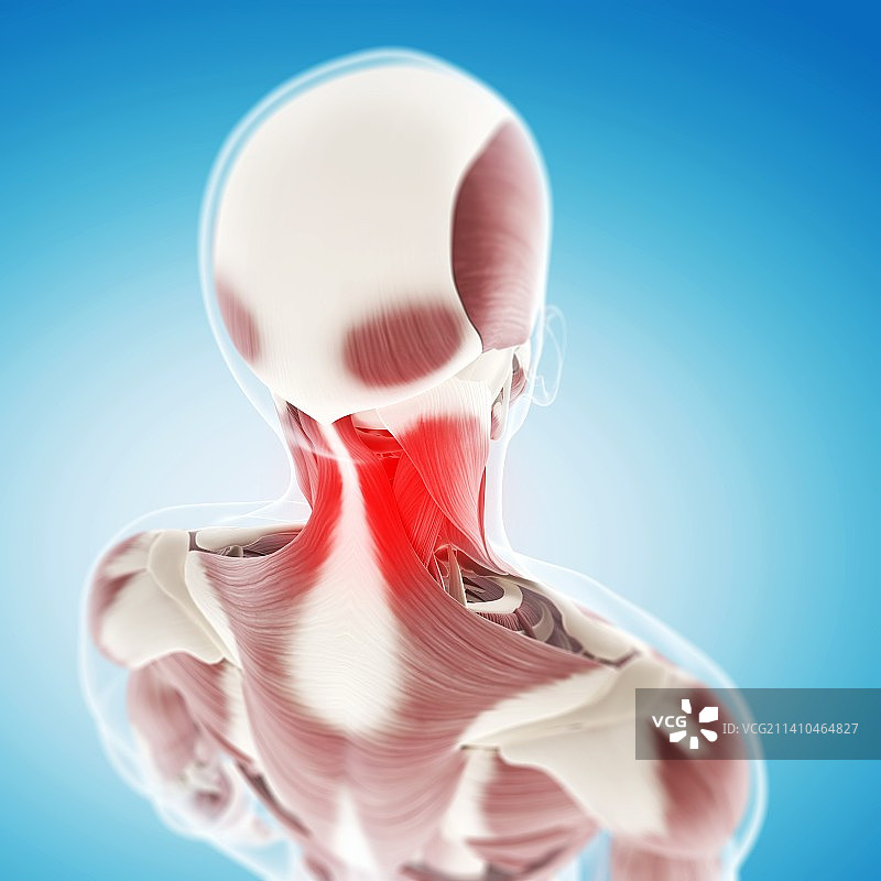 颈部疼痛概念艺术作品图片素材