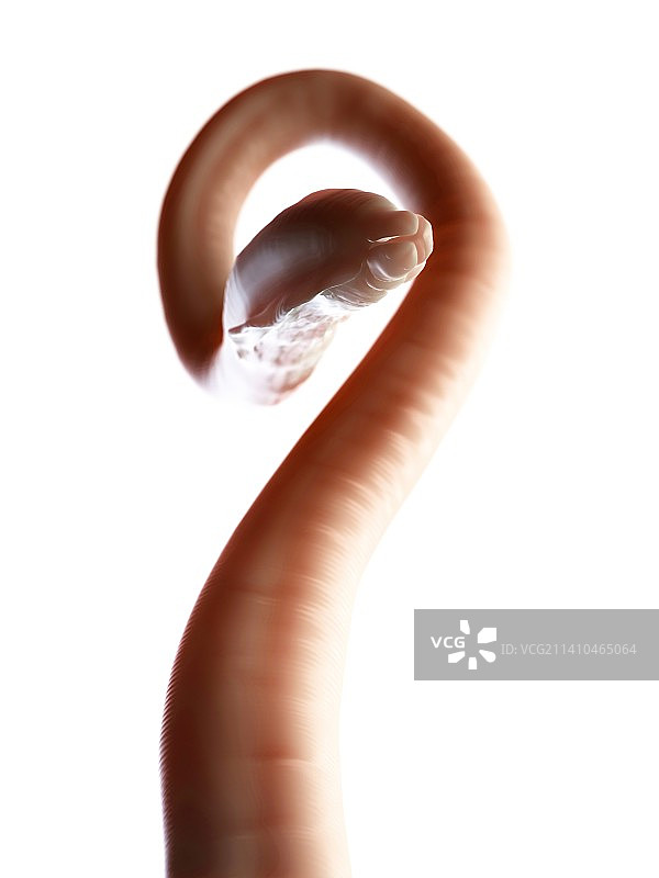 蛔虫、概念插画图片素材