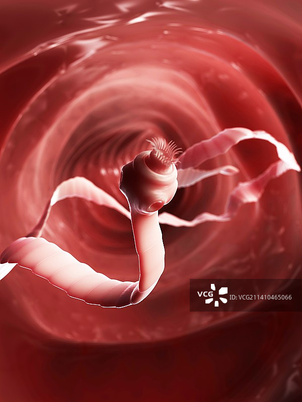 绦虫、概念插画图片素材