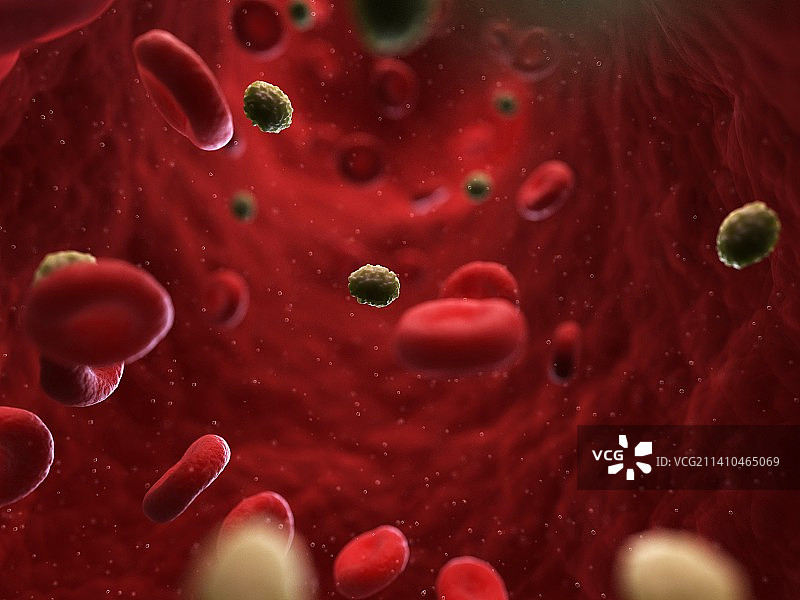 天花感染插图图片素材