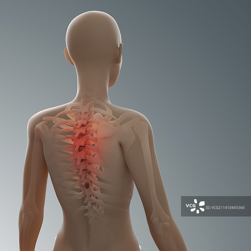 背痛，概念性艺术作品图片素材