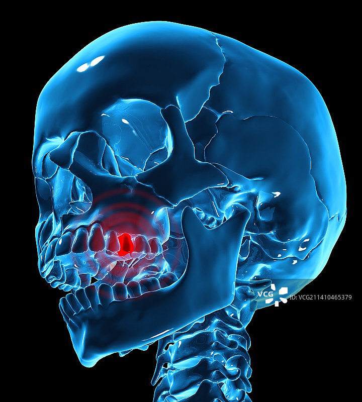 牙痛概念艺术作品图片素材