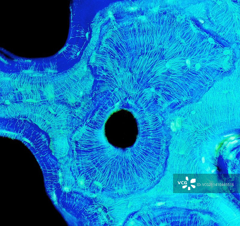 骨骼结构显微照片图片素材