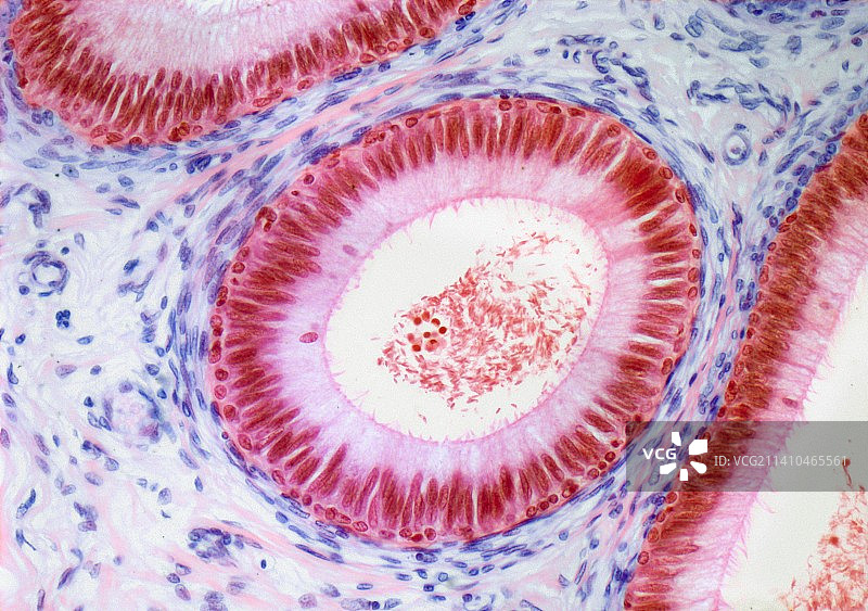 附睾，显微照片图片素材