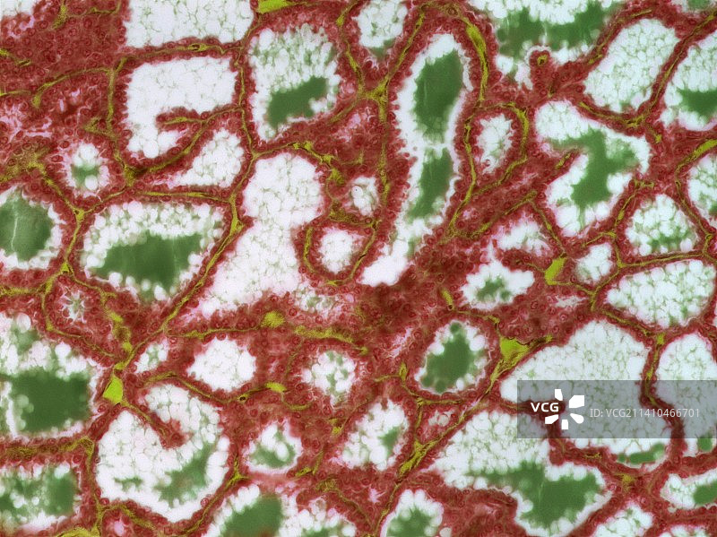 哺乳期乳腺组织光学显微照片图片素材