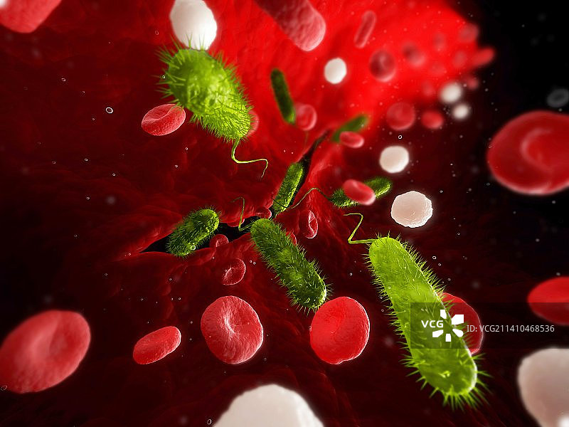 细菌感染艺术图图片素材