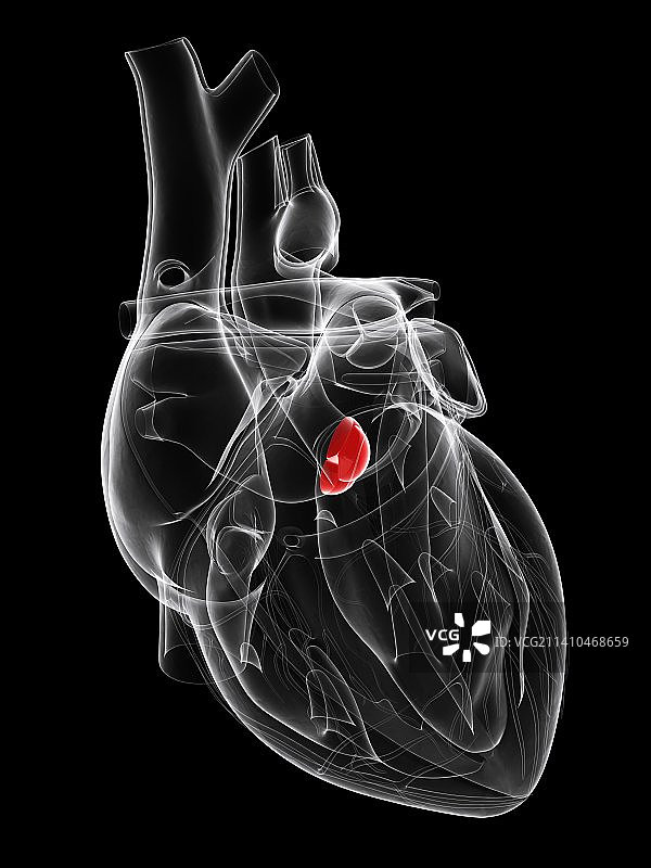 主动脉瓣艺术图图片素材