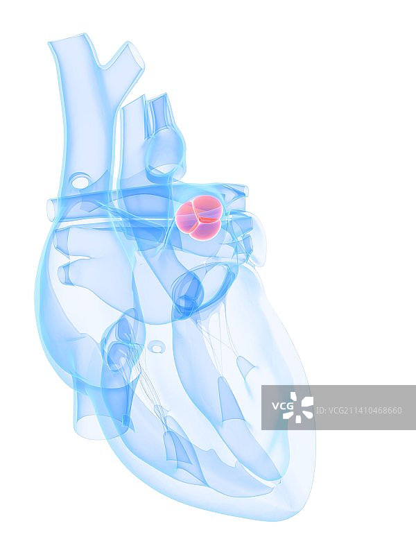 主动脉瓣艺术图图片素材