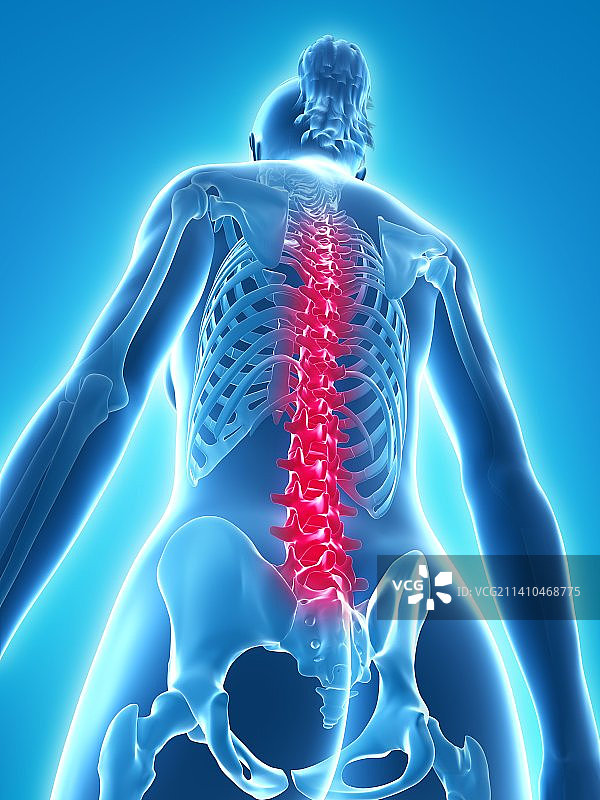 背痛，概念性艺术作品图片素材