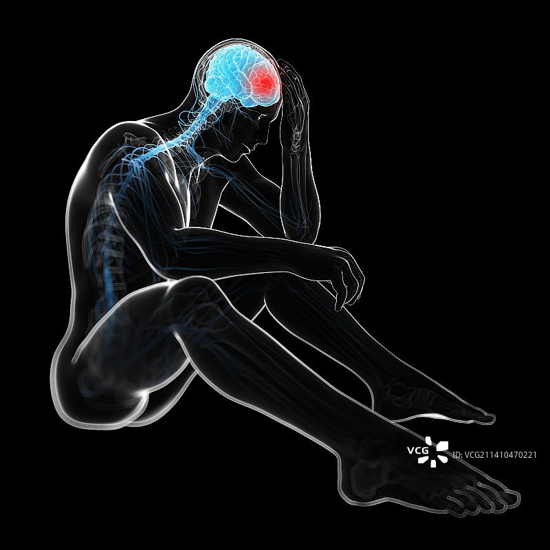 头痛，艺术作品图片素材