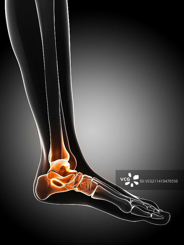 脚踝疼痛概念艺术作品图片素材