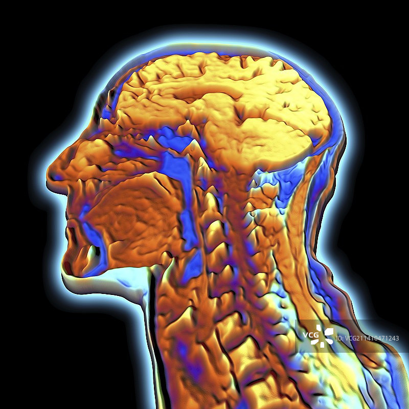 人头部的核磁共振成像图片素材