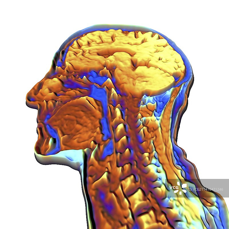 人头彩色核磁共振扫描图片素材