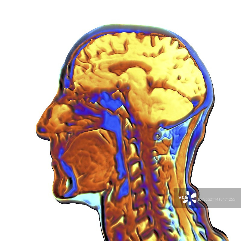 人头彩色核磁共振扫描图片素材