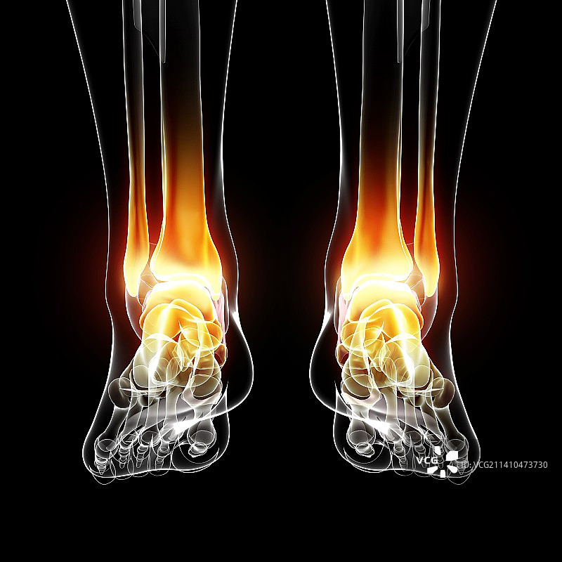 脚踝疼痛医学插画图片素材