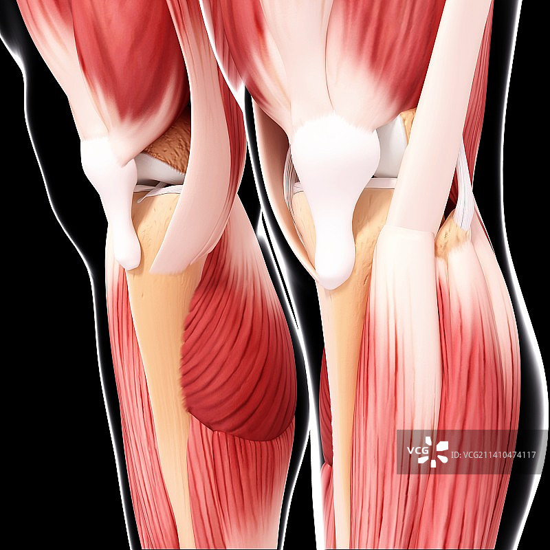 人类腿部肌肉组织，艺术品图片素材
