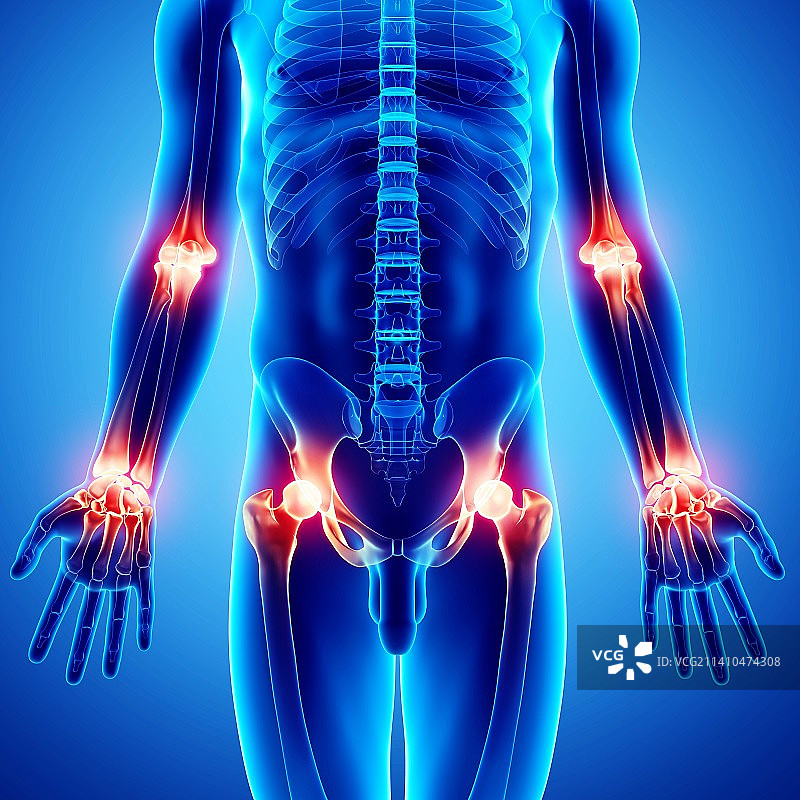 关节疼痛艺术作品图片素材