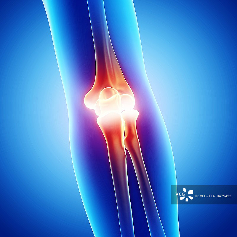 肘部疼痛插画图片素材