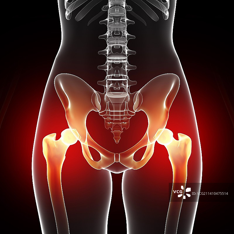 盆腔疼痛艺术作品图片素材