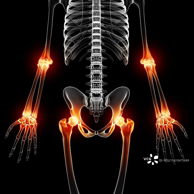 关节疼痛艺术作品图片素材