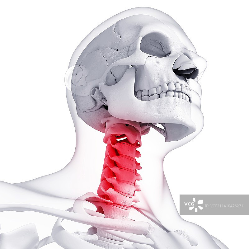 颈部疼痛，艺术作品图片素材
