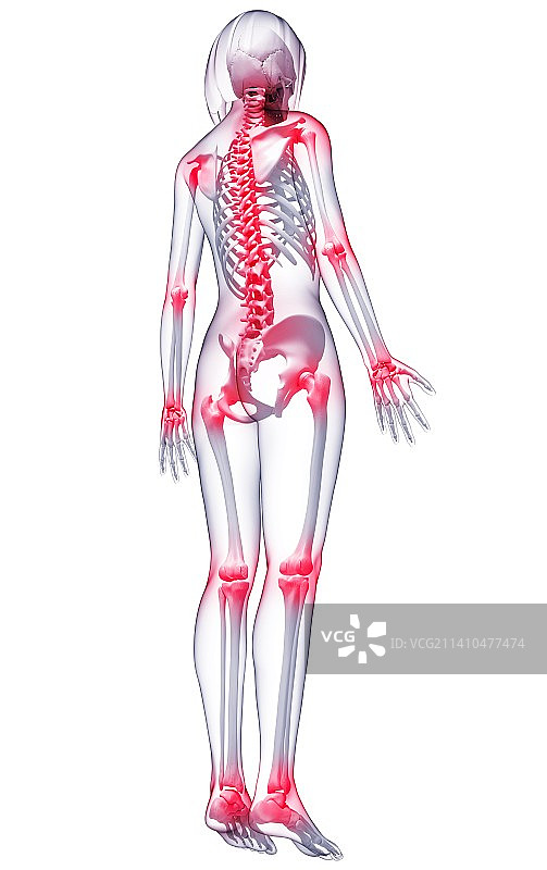 关节疼痛艺术作品图片素材