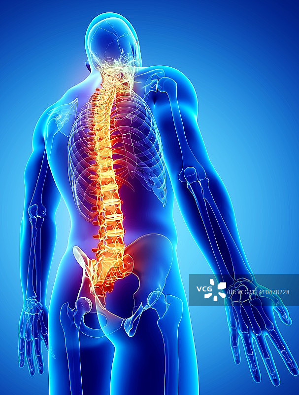 背痛，示意图，仅做科普示意。图片素材