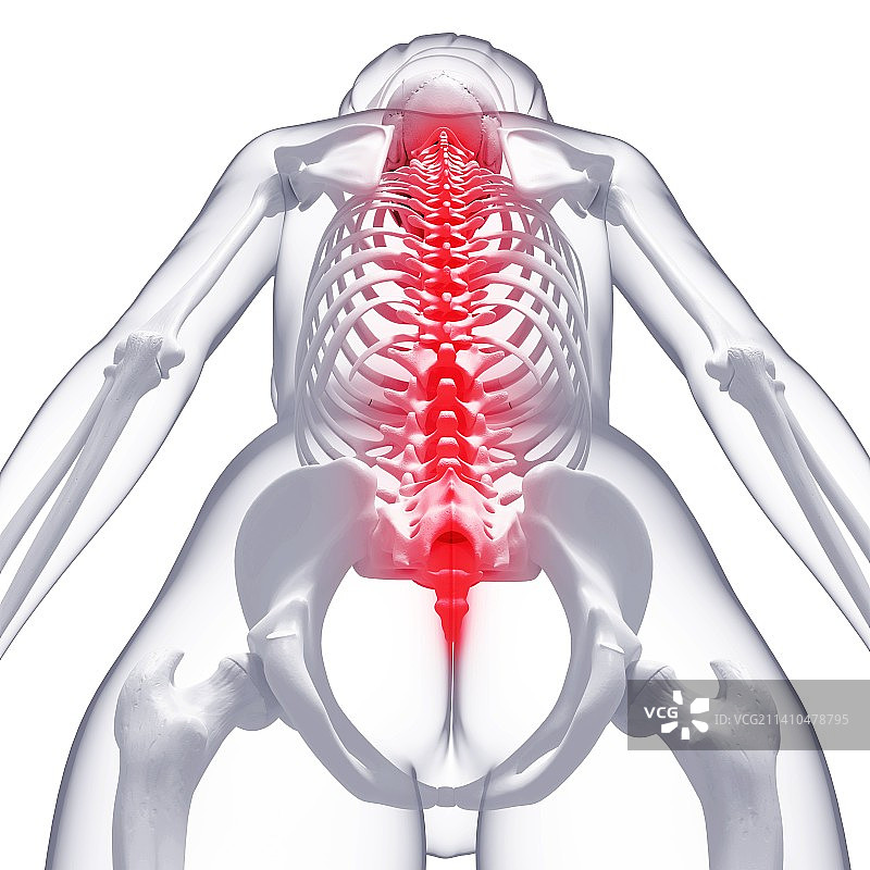 背痛艺术作品图片素材