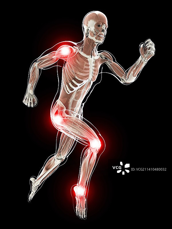 关节疼痛（艺术作品）图片素材